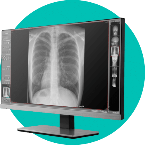 Nuon Imaging miVet Computer