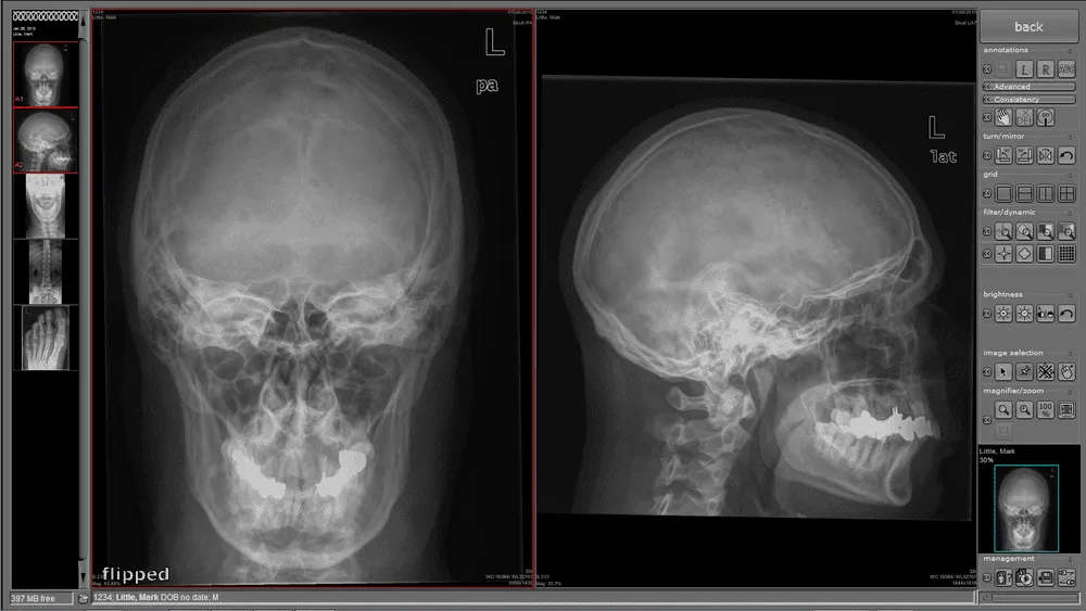 Nuon Imaging - NuonHuman Software 9