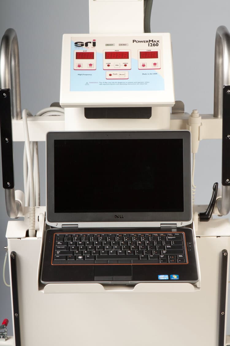 SR130DU_Laptop2-1 - Nuon Imaging - Human Radiology Equipment