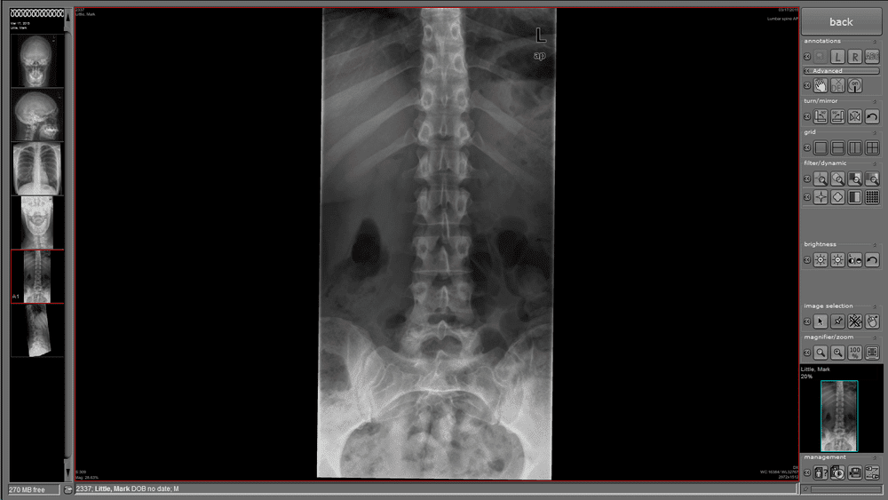 Nuon Imaging - NuonHuman Software 5