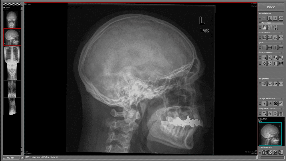 Nuon Imaging - NuonHuman Software 8