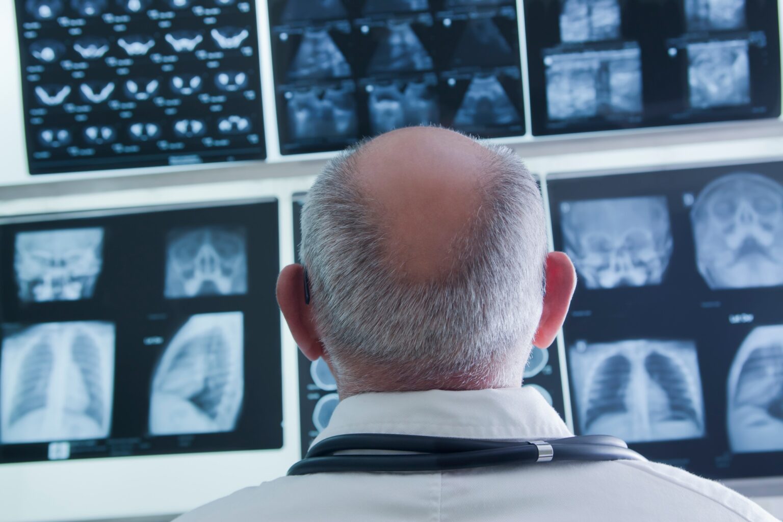 Doctor analysing scan results