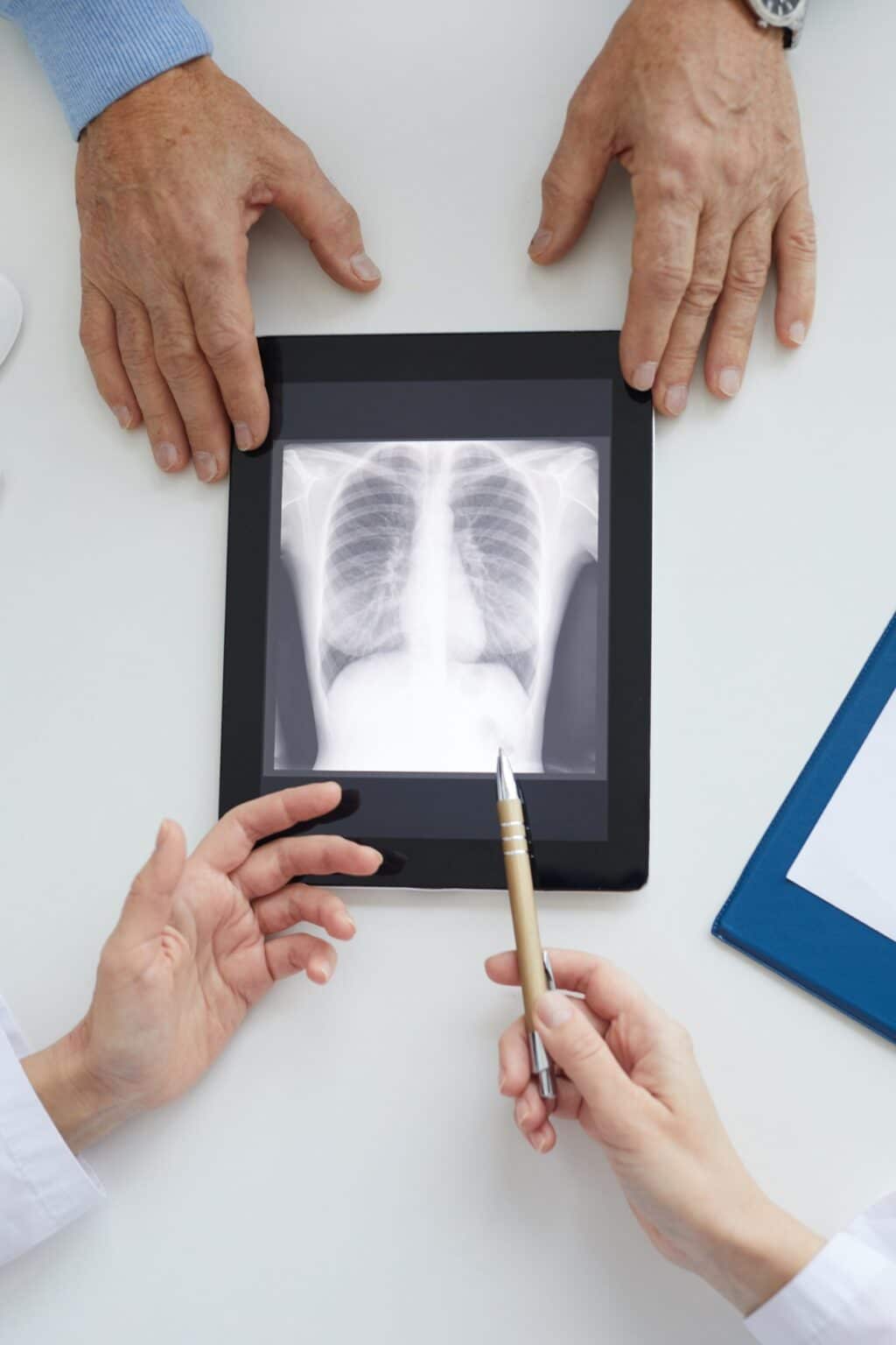 Doctor Explaining Lung X-ray Closeup