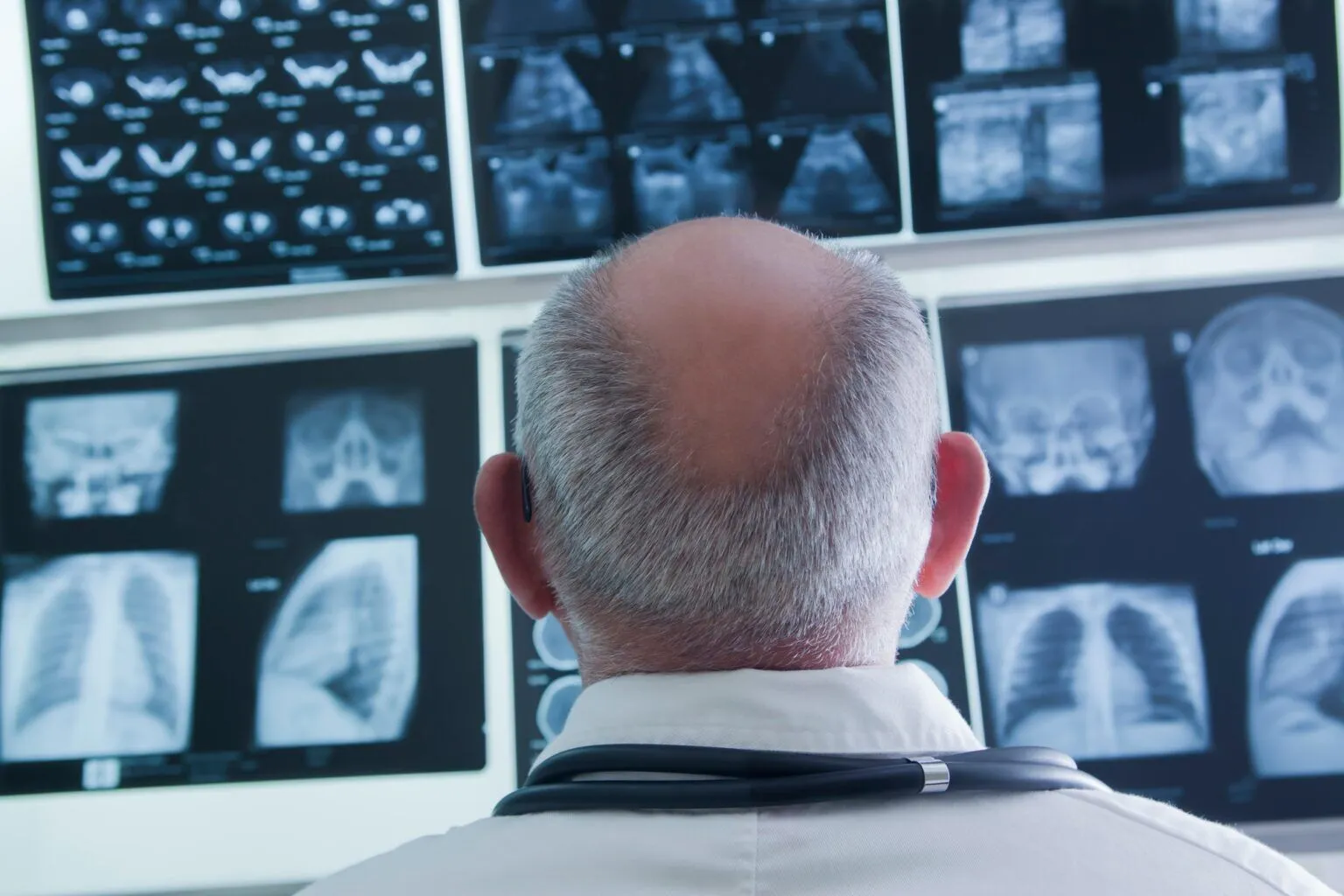 Doctor analysing scan results