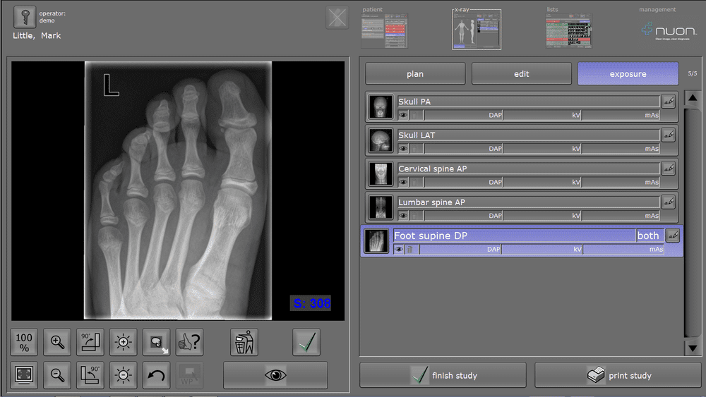 Nuon Imaging - NuonHuman Software 10