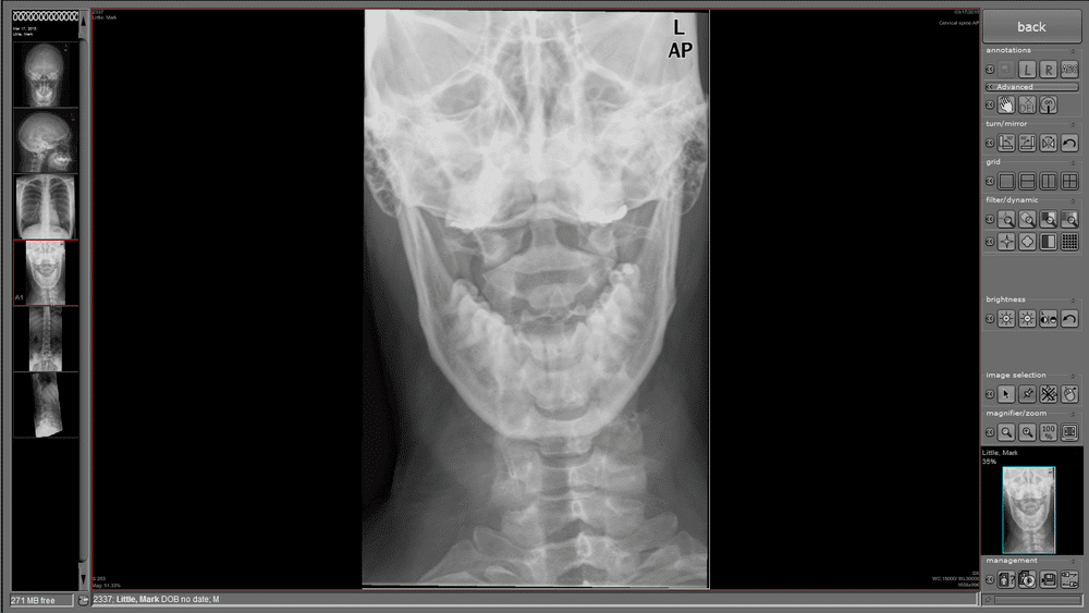 Nuon Imaging - NuonHuman Software 6