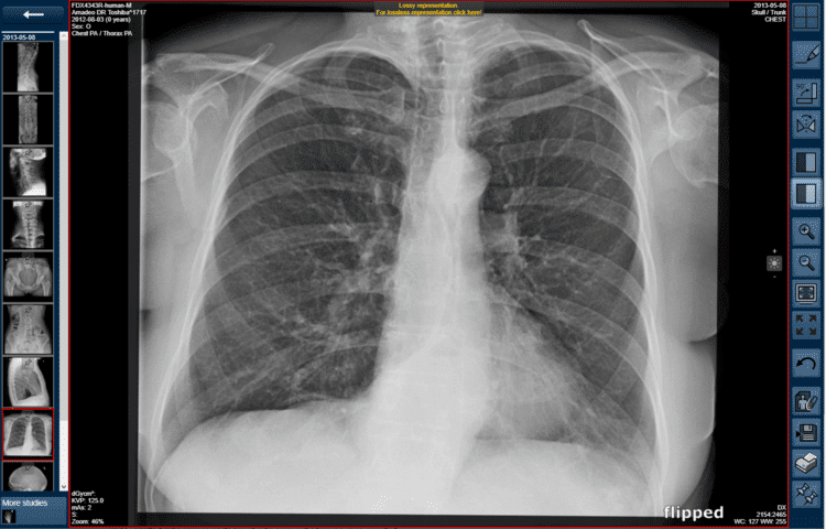 Nuon Imaging Archived Images Chest