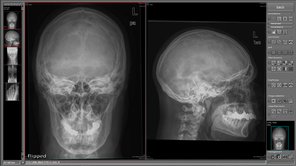 Nuon Imaging - NuonHuman Software 9