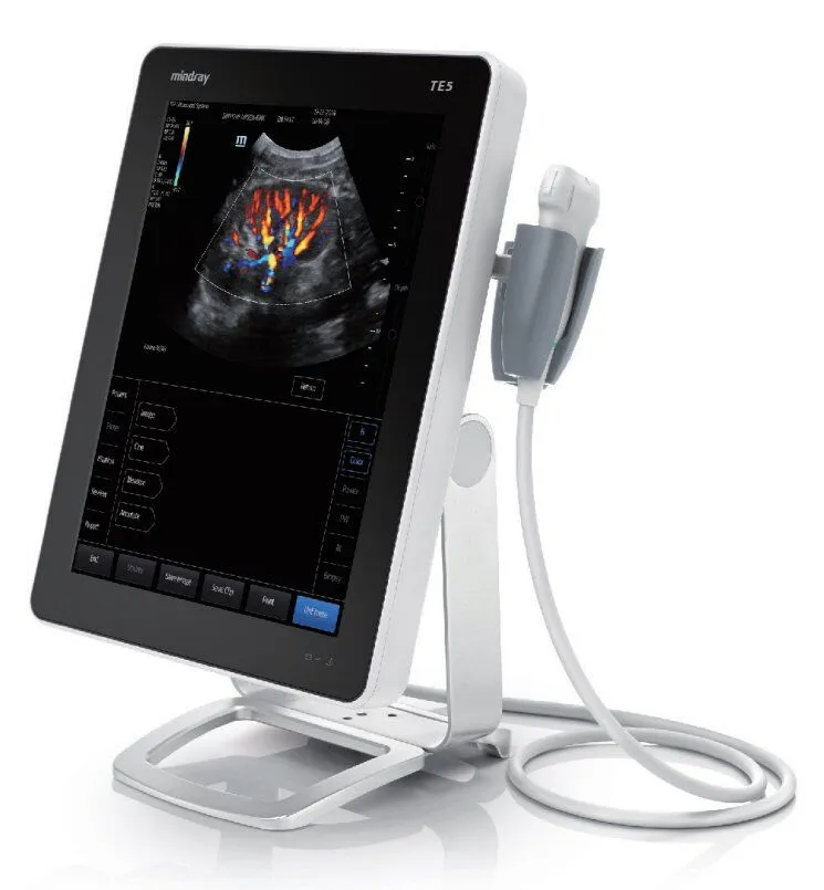 miVetSource TE5 Vet Ultrasound - Veterinary Radiology Equipment