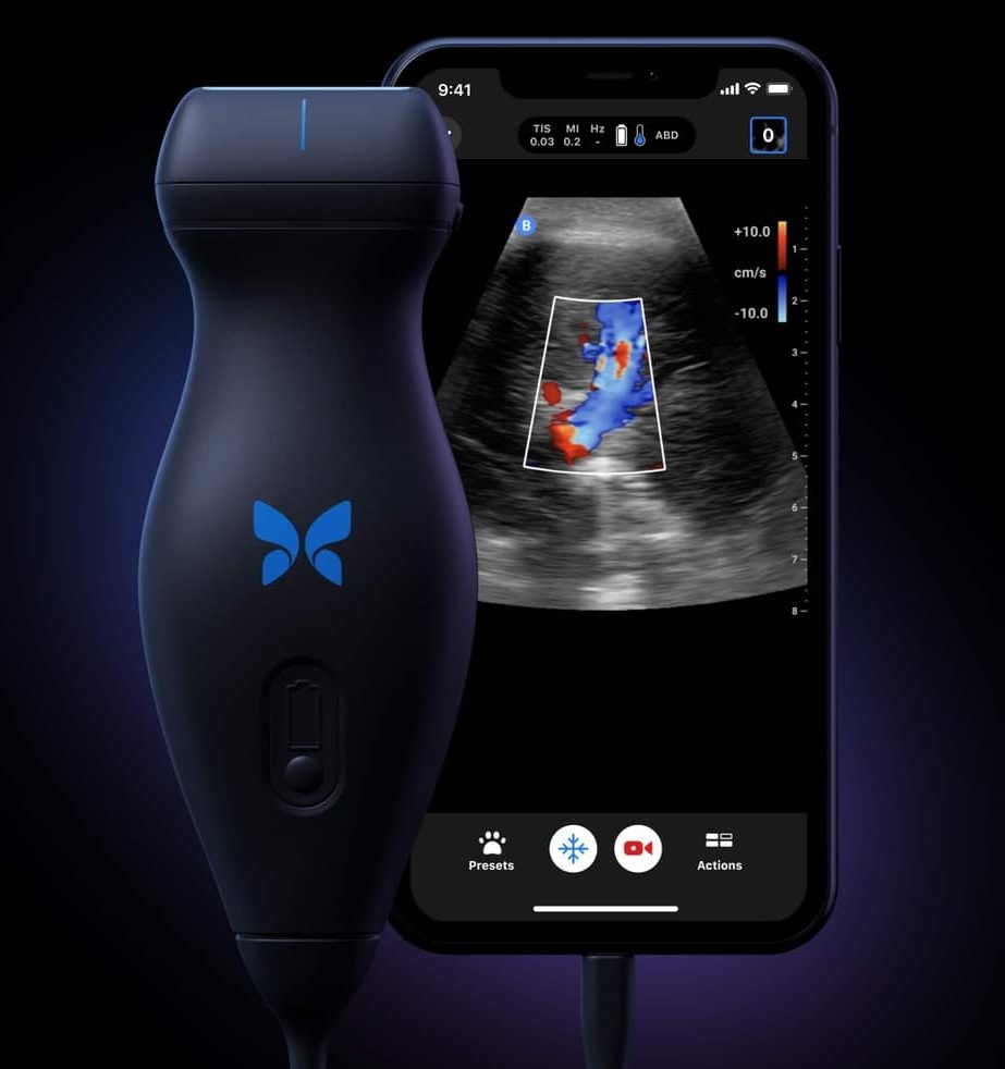 Butterfly iQ+ Vet - Nuon Imaging - Veterinary Radiology Equipment 2