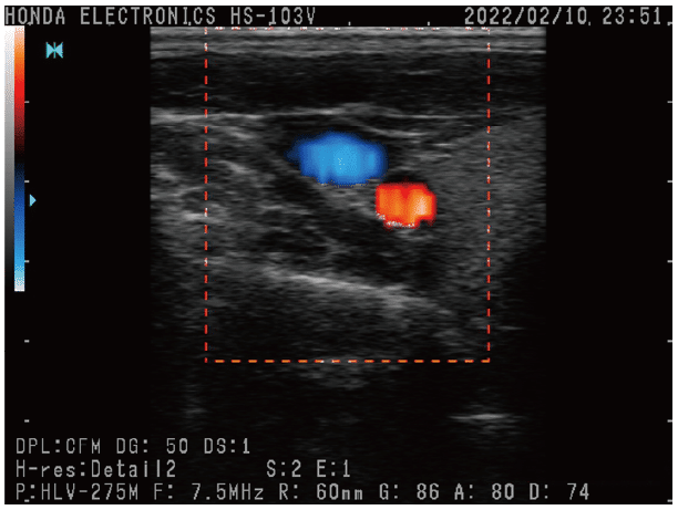 Honda HS-103V Portable Veterinary Ultrasound View