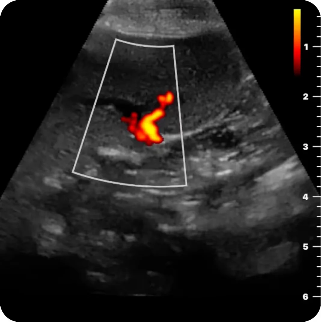 Butterfly iQ3 Vet Point-of-Care Ultrasound Abdominal Investigations