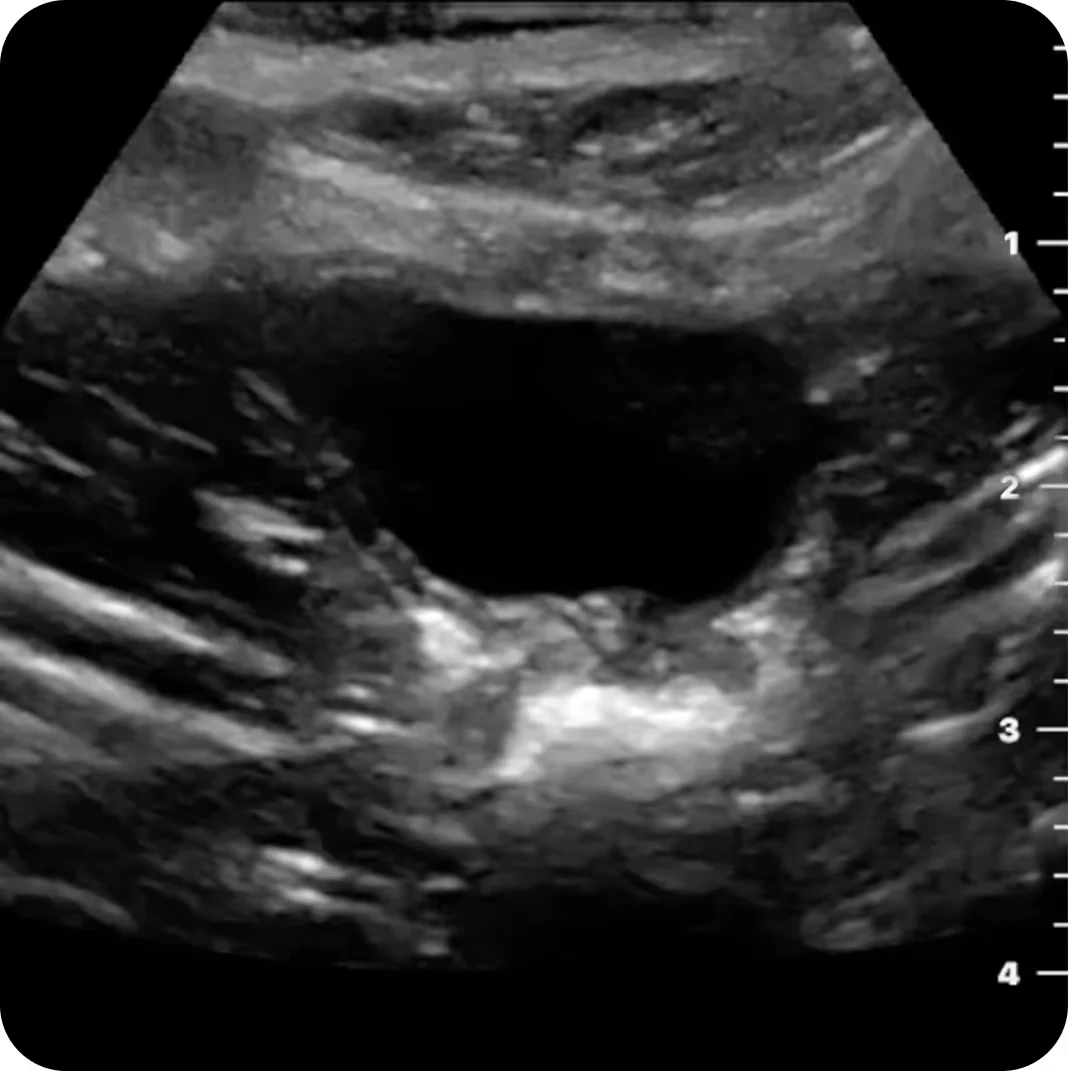 Butterfly iQ3 Vet Point-of-Care Ultrasound Bladder Examinations